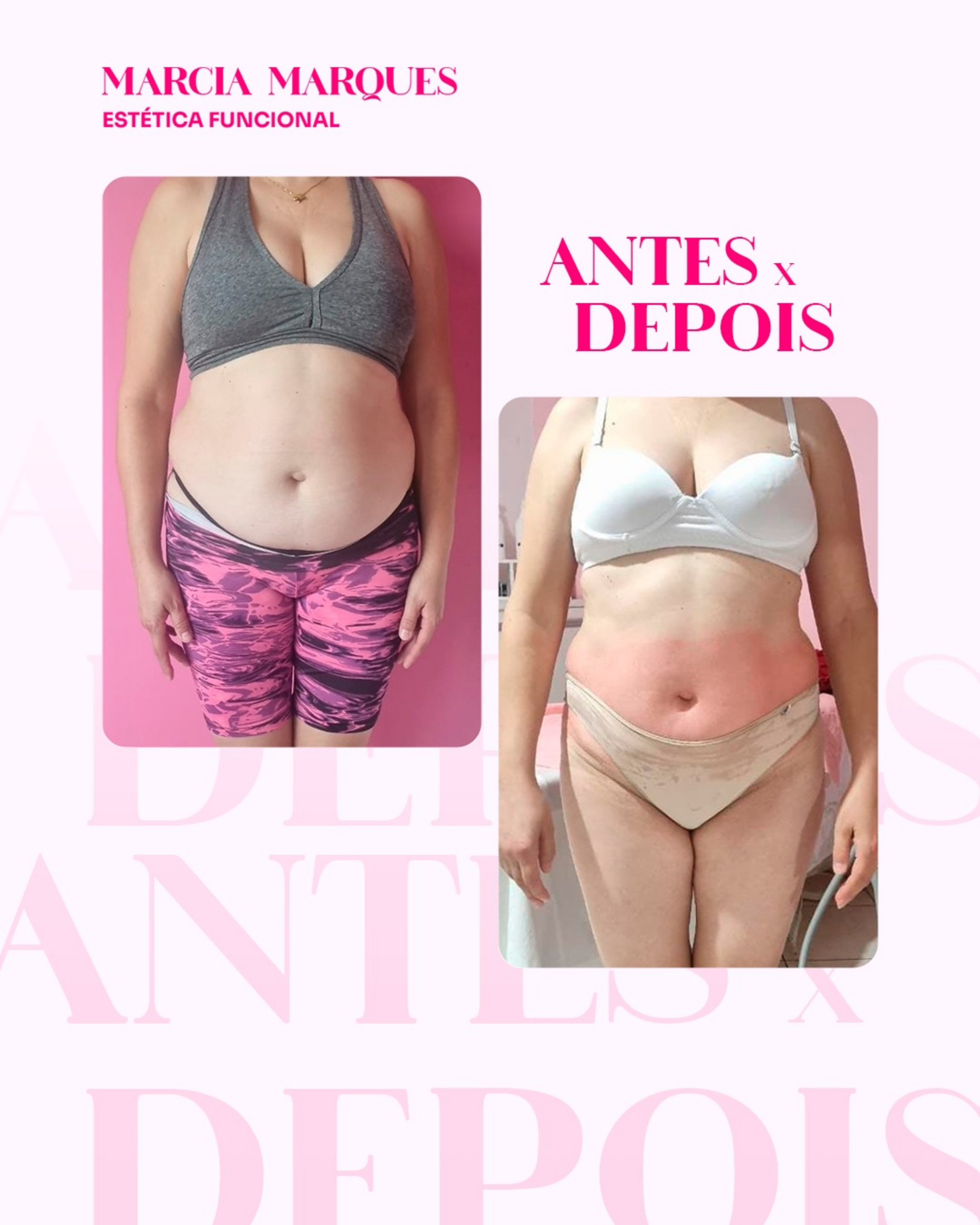 Antes e Depois 1